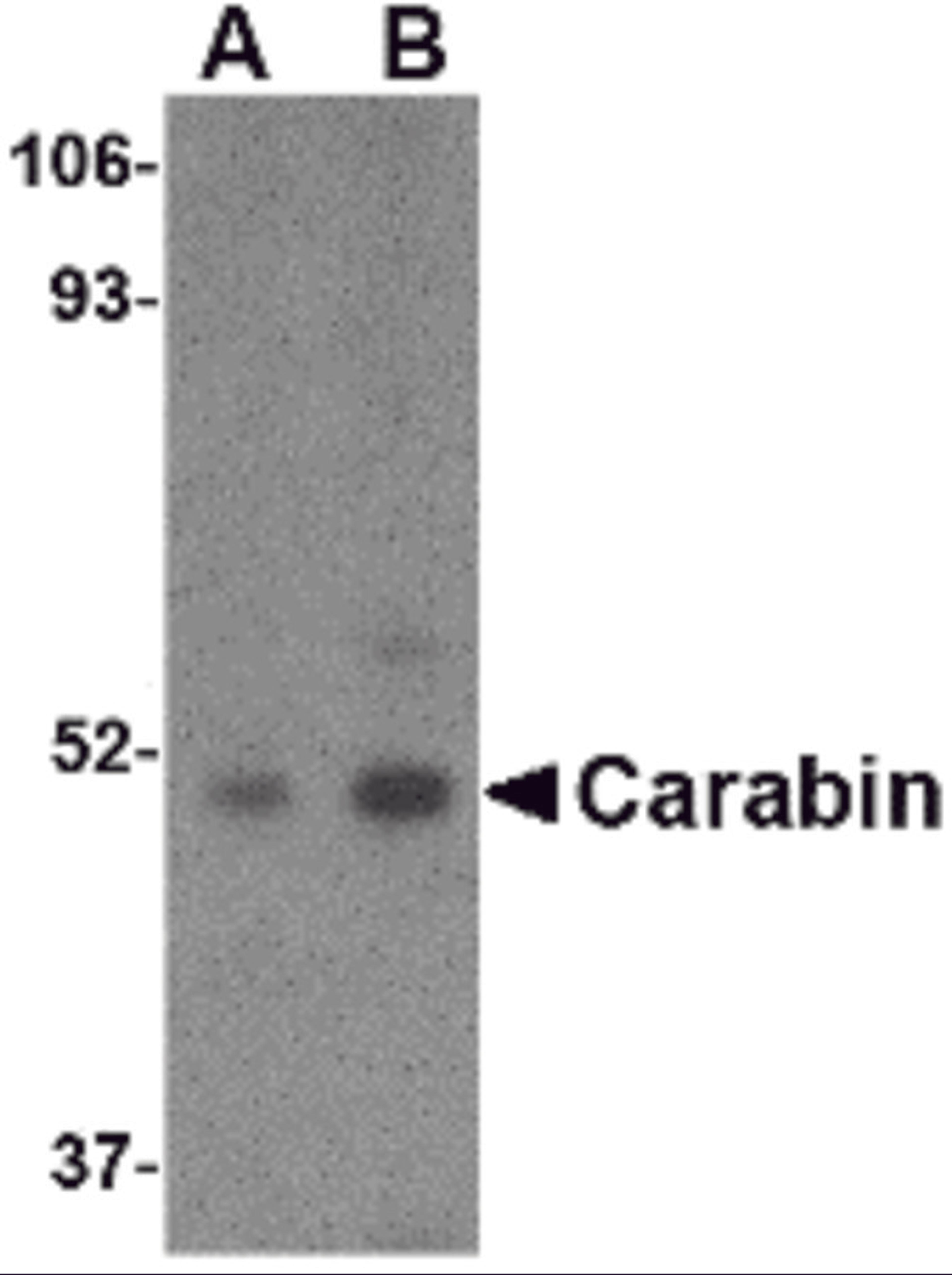 Western blot analysis of Carabin in Daudi cell lysate with Carabin antibody at (A) 1 and (B) 2 μg/mL.