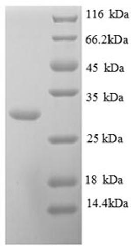 (Tris-Glycine gel) Discontinuous SDS-PAGE (reduced) with 5% enrichment gel and 15% separation gel.