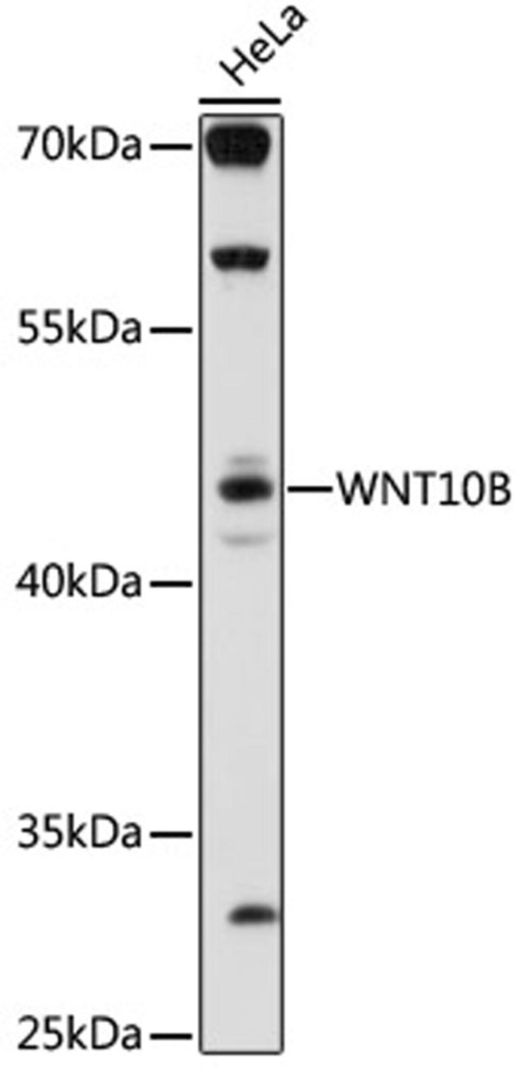 Western blot - WNT10B antibody (A16717)