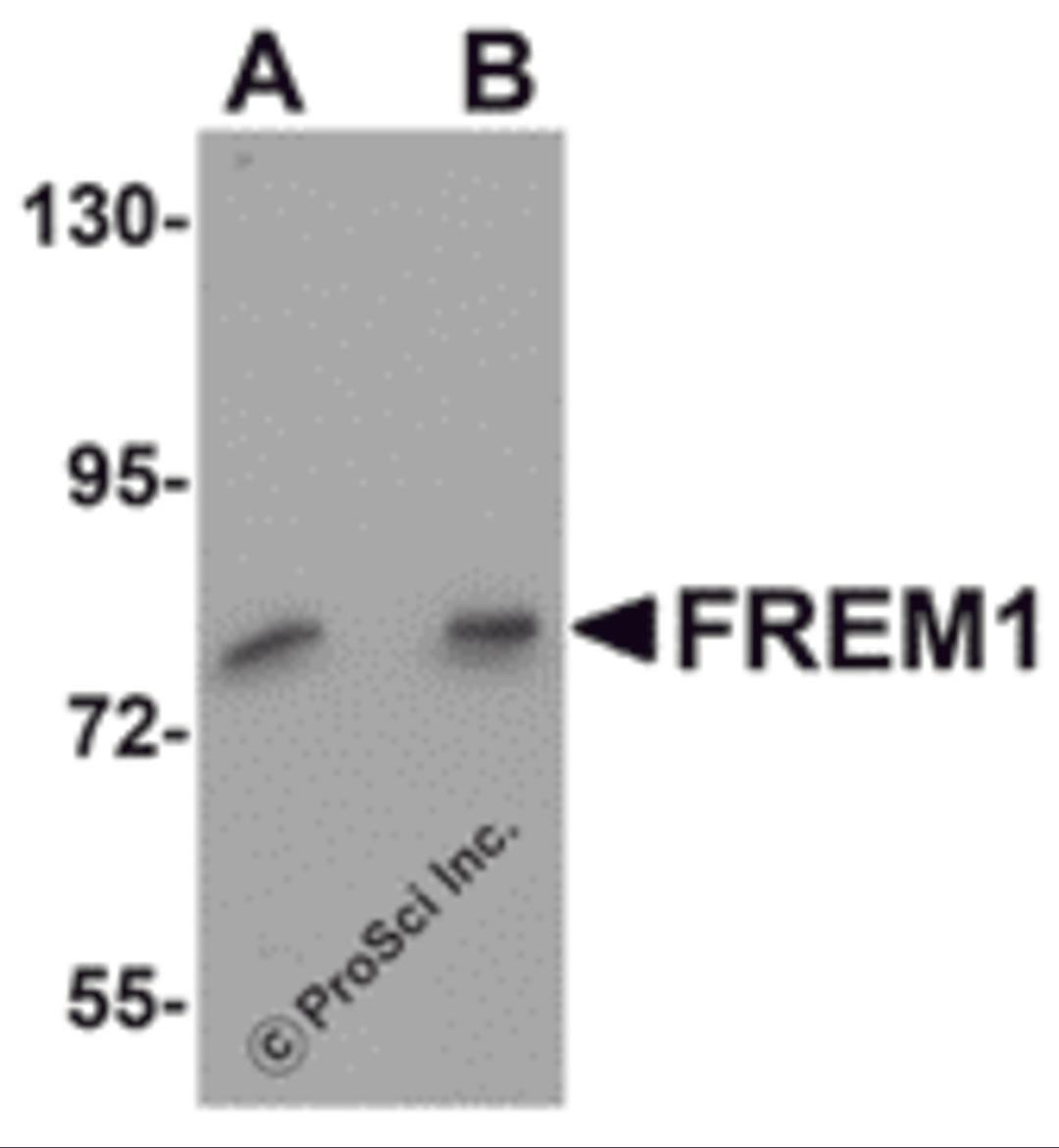 Western blot analysis of FREM1 in K562 cell lysate with FREM1 antibody at (A) 0.5 and (B) 1μg/mL.