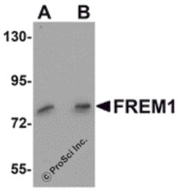 Western blot analysis of FREM1 in K562 cell lysate with FREM1 antibody at (A) 0.5 and (B) 1μg/mL.