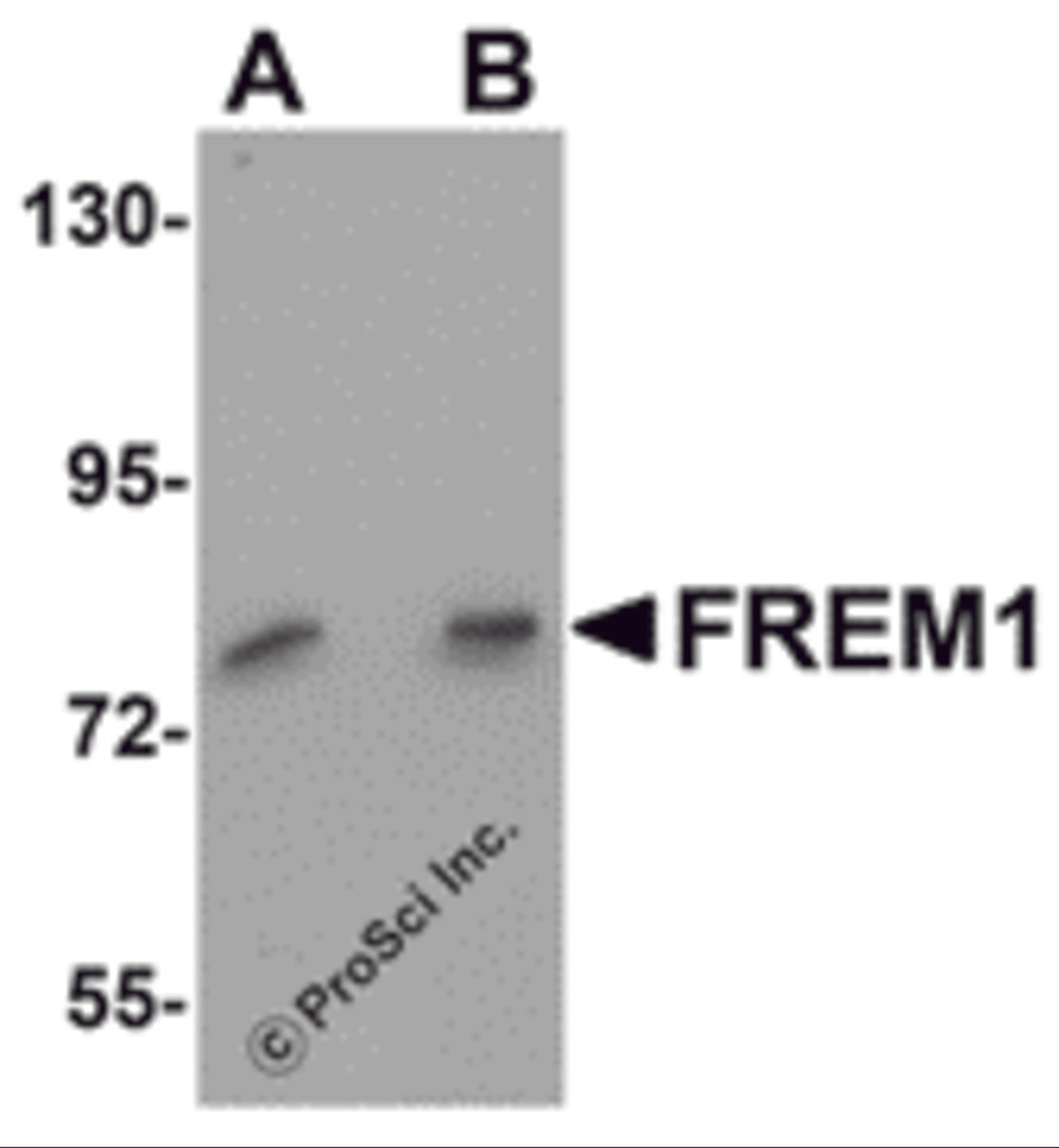 Western blot analysis of FREM1 in K562 cell lysate with FREM1 antibody at (A) 0.5 and (B) 1μg/mL.