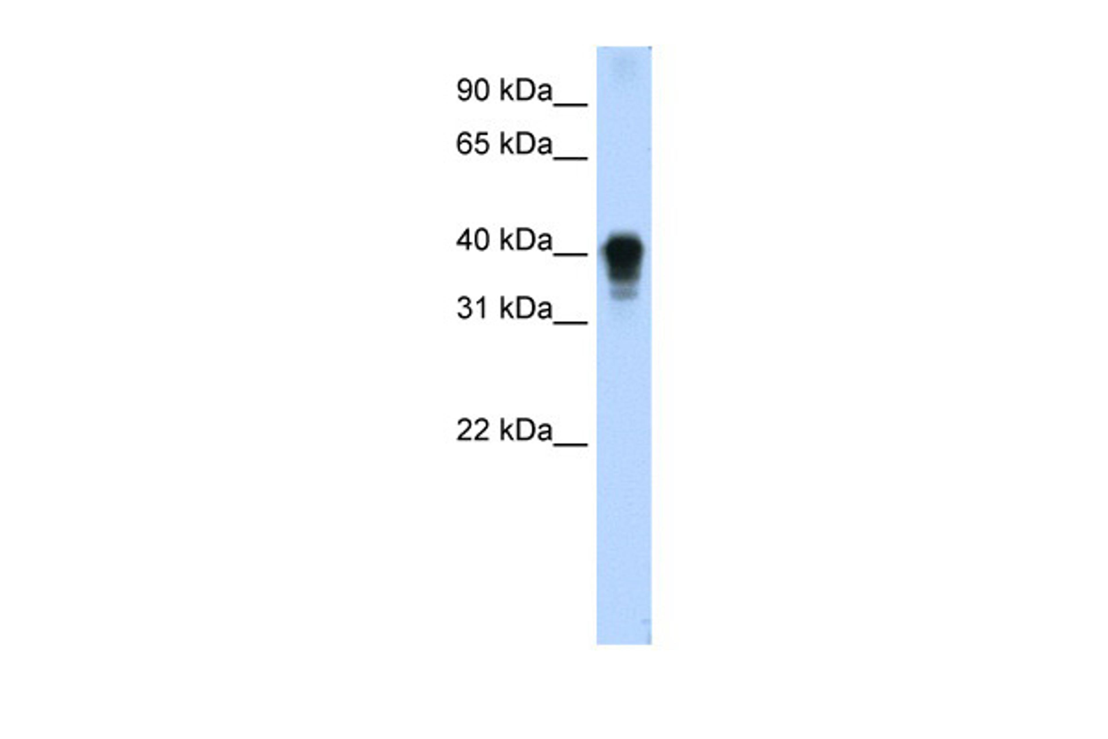 Antibody used in WB on Human Thymus at 0.2-1 ug/ml.