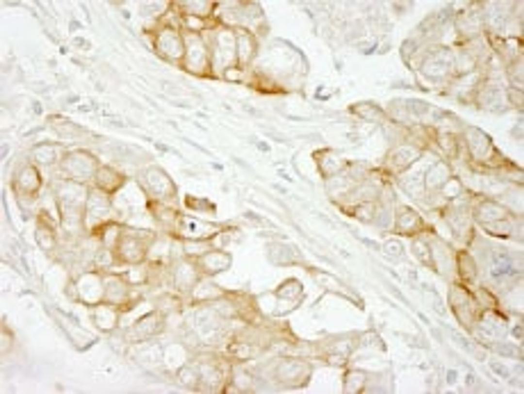 Detection of human Notch2 immunohistochemistry.