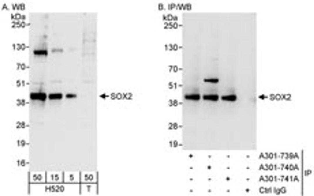 Detection of human SOX2 by western blot and immunoprecipitation.