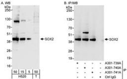 Detection of human SOX2 by western blot and immunoprecipitation.