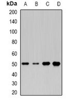 Western blot analysis of HepG2 (Lane1), Jurkat (Lane2), mouse liver (Lane3), rat heart (Lane4) whole cell lysates using MOCS3 antibody