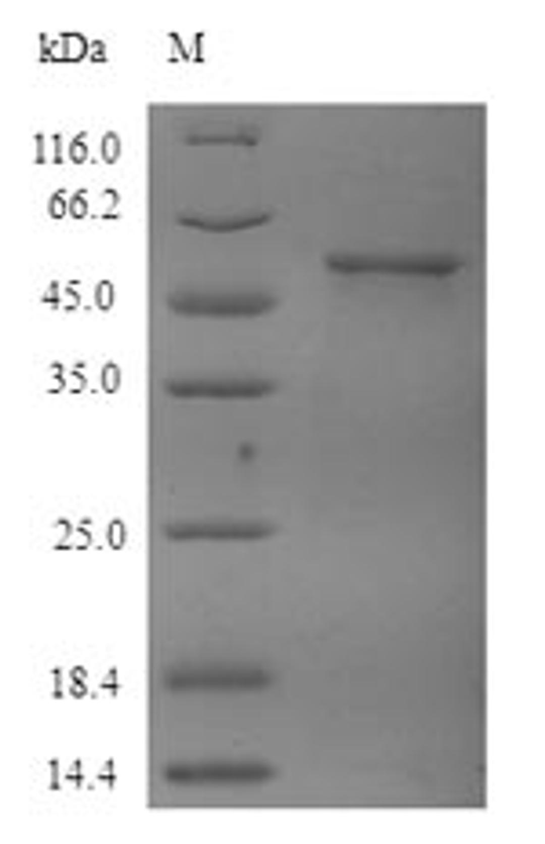 (Tris-Glycine gel) Discontinuous SDS-PAGE (reduced) with 5% enrichment gel and 15% separation gel.