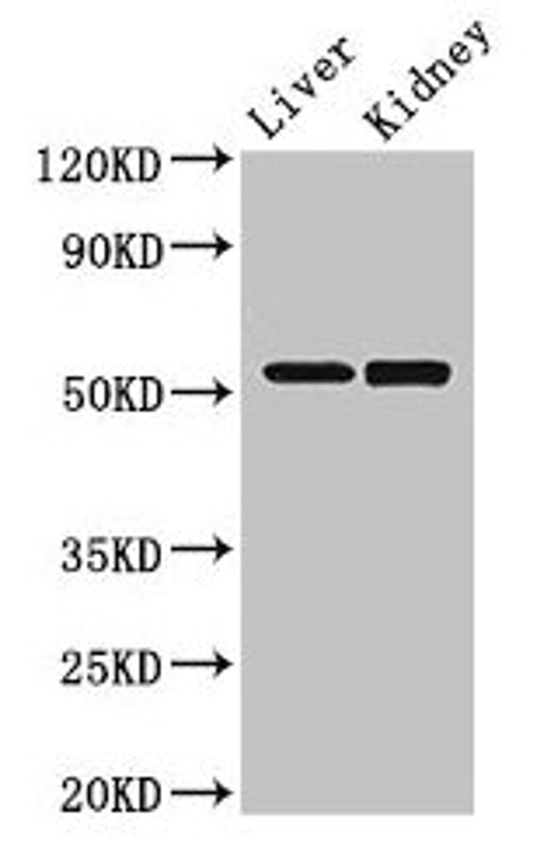 Western Blot. Positive WB detected in: Mouse liver tissue, Mouse kidney tissue. All lanes: PNLIPRP3 antibody at 3.5µg/ml. Secondary. Goat polyclonal to rabbit IgG at 1/50000 dilution. Predicted band size: 53 kDa. Observed band size: 53 kDa