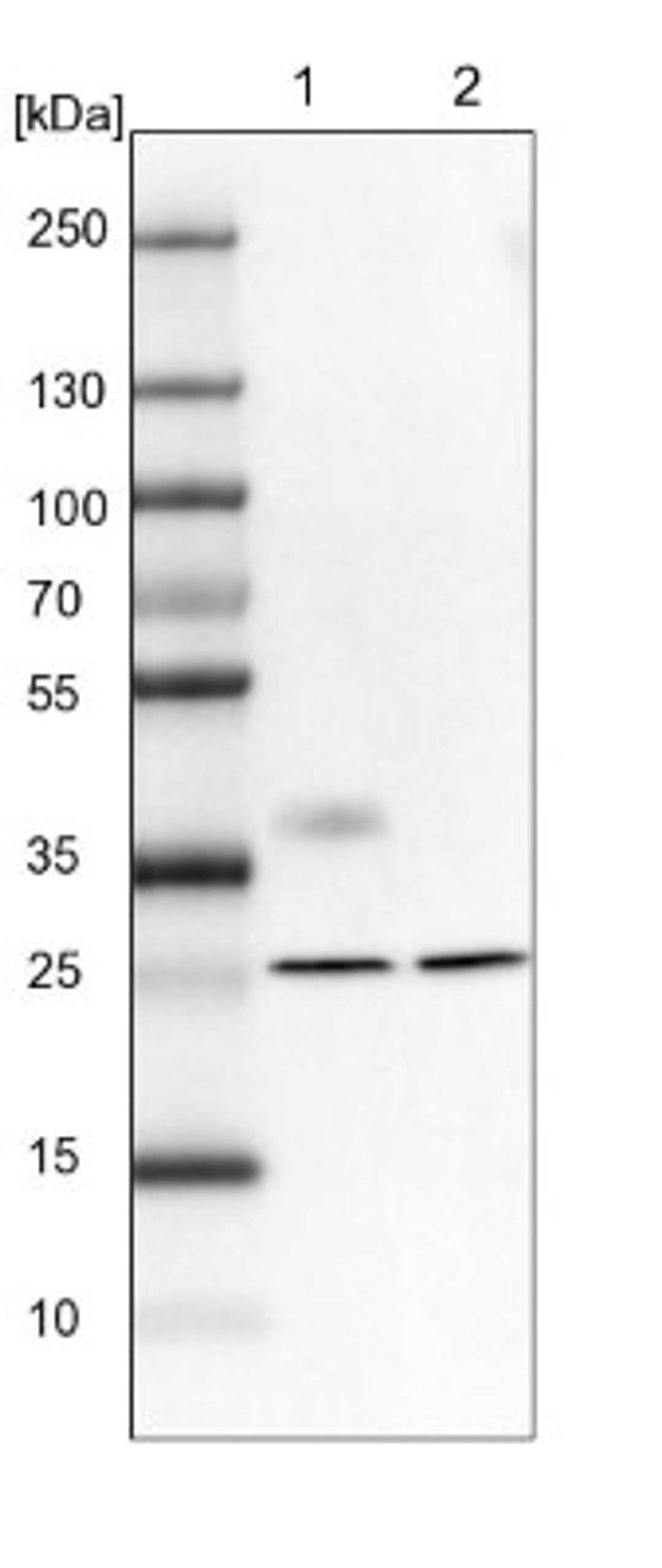 Western Blot: MXRA7 Antibody [NBP1-93731] - Lane 1: NIH-3T3 cell lysate (Mouse embryonic fibroblast cells)<br/>Lane 2: NBT-II cell lysate (Rat Wistar bladder tumour cells)