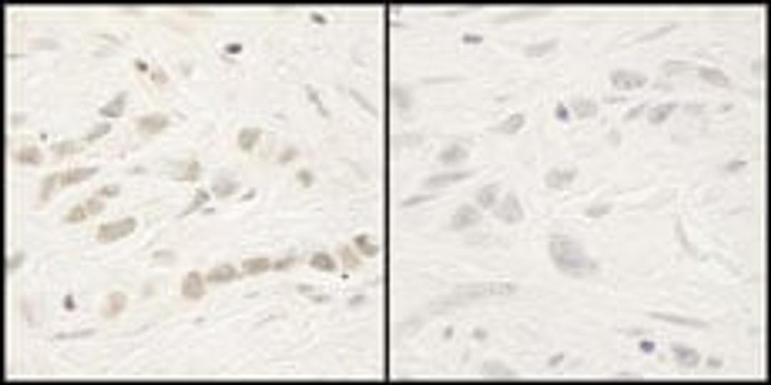 Detection of human Phospho-RelA (S468) by immunohistochemistry.