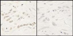 Detection of human Phospho-RelA (S468) by immunohistochemistry.