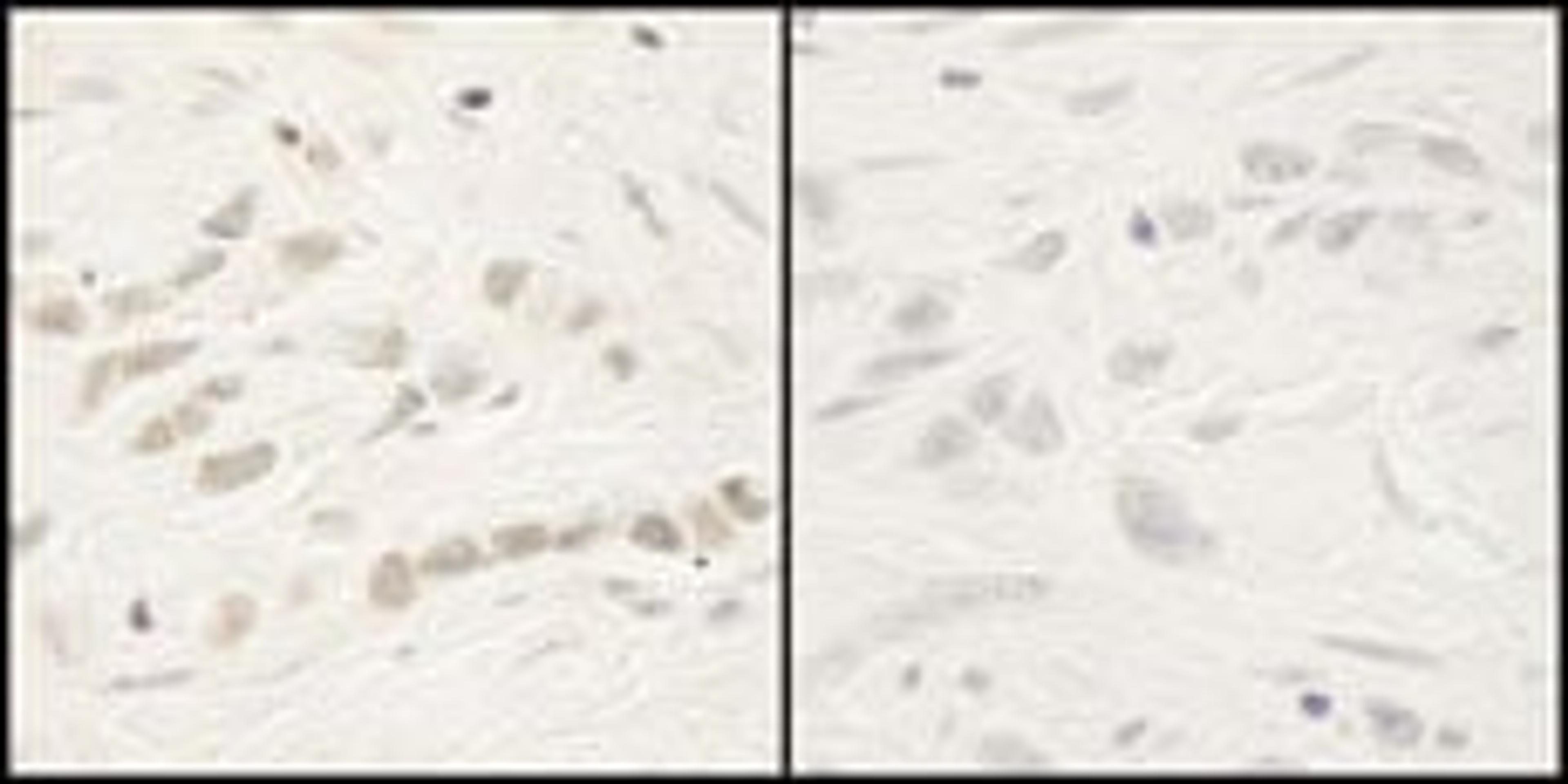 Detection of human Phospho-RelA (S468) by immunohistochemistry.