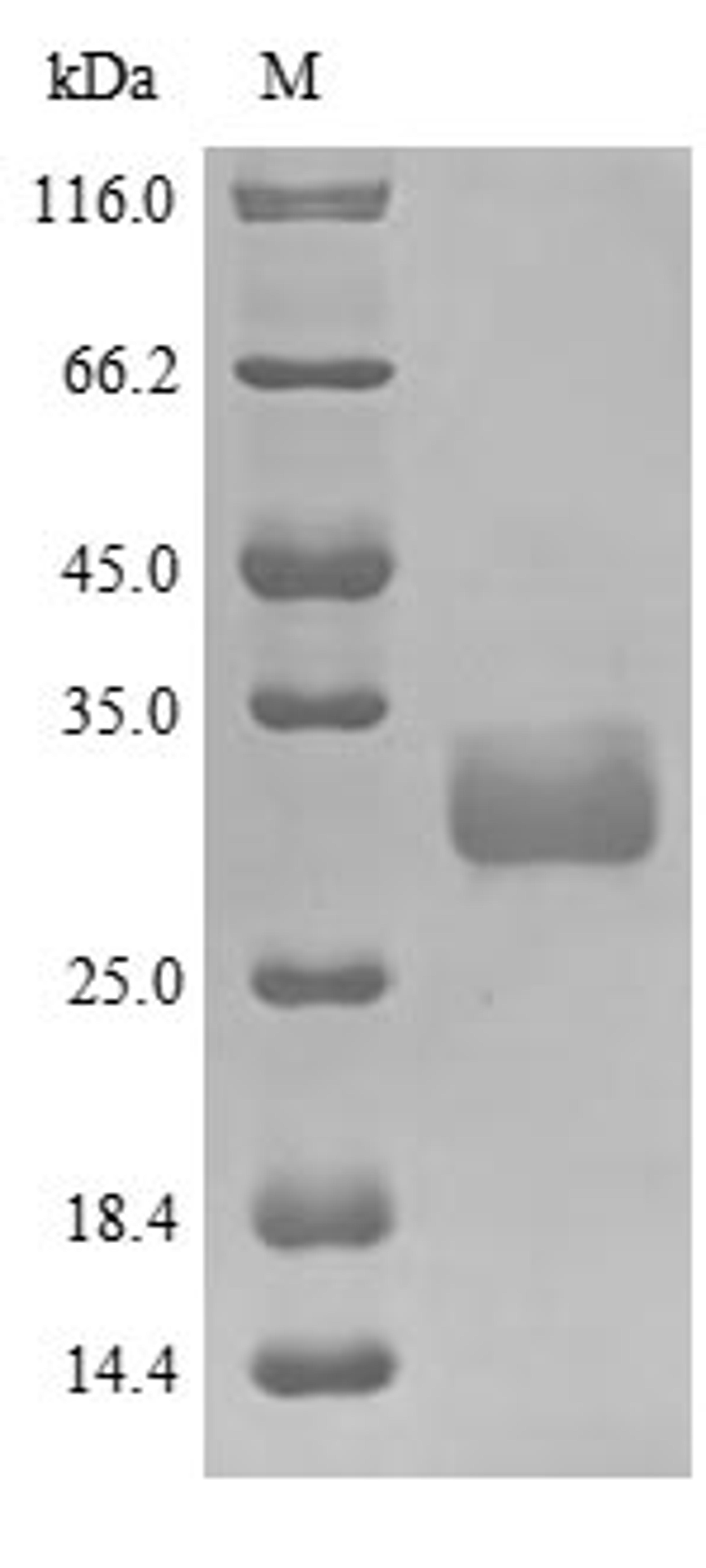 (Tris-Glycine gel) Discontinuous SDS-PAGE (reduced) with 5% enrichment gel and 15% separation gel.