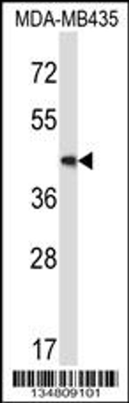 Western blot analysis in MDA-MB435 cell line lysates (35ug/lane).