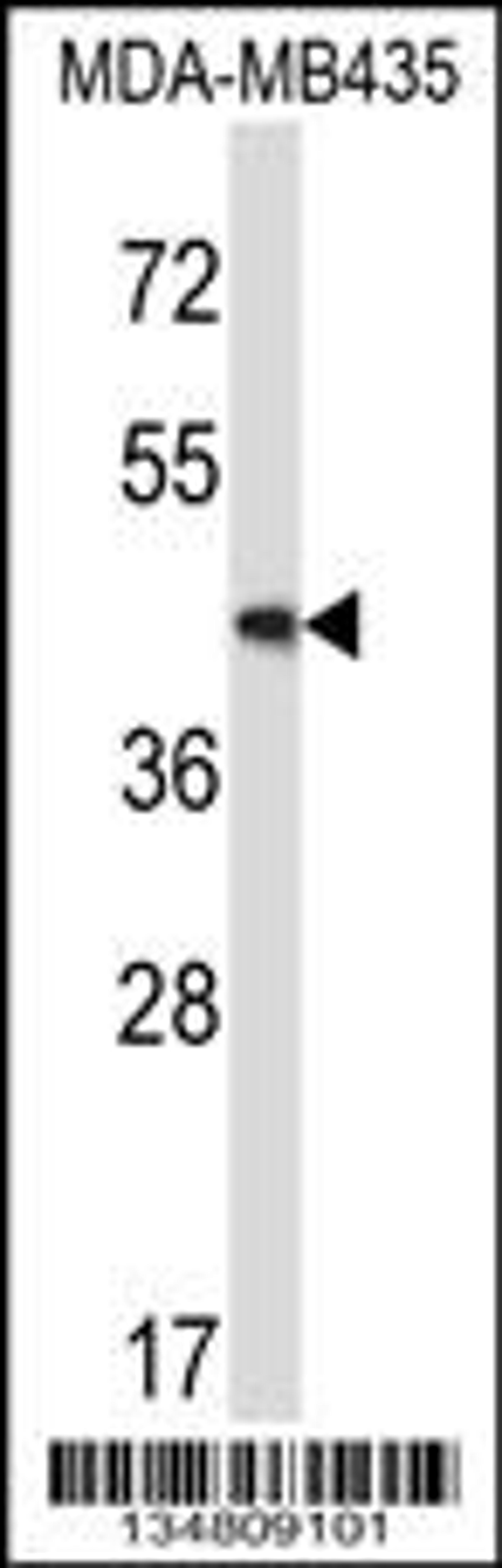 Western blot analysis in MDA-MB435 cell line lysates (35ug/lane).