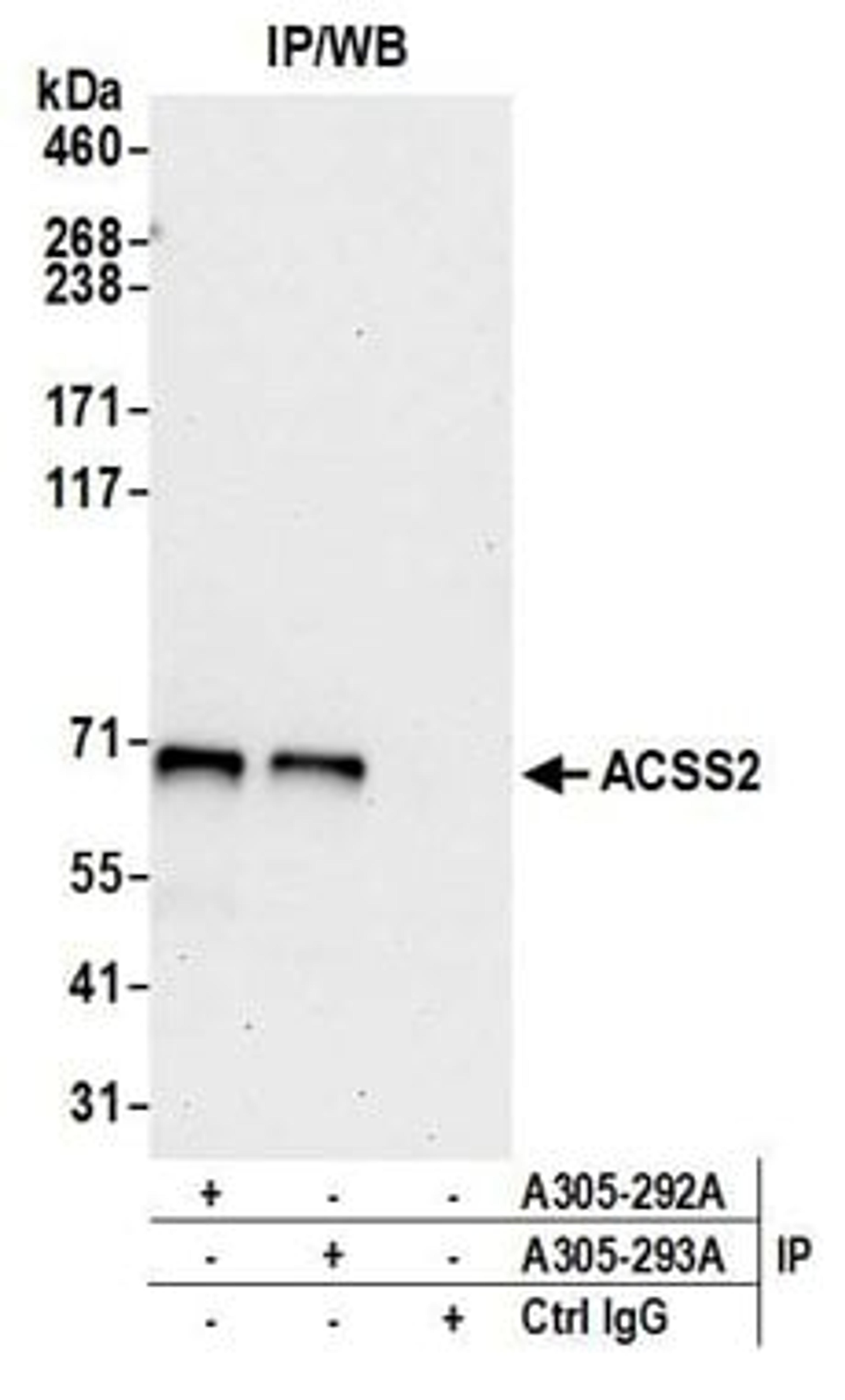 Detection of human ACSS2 by western blot of immunoprecipitates.