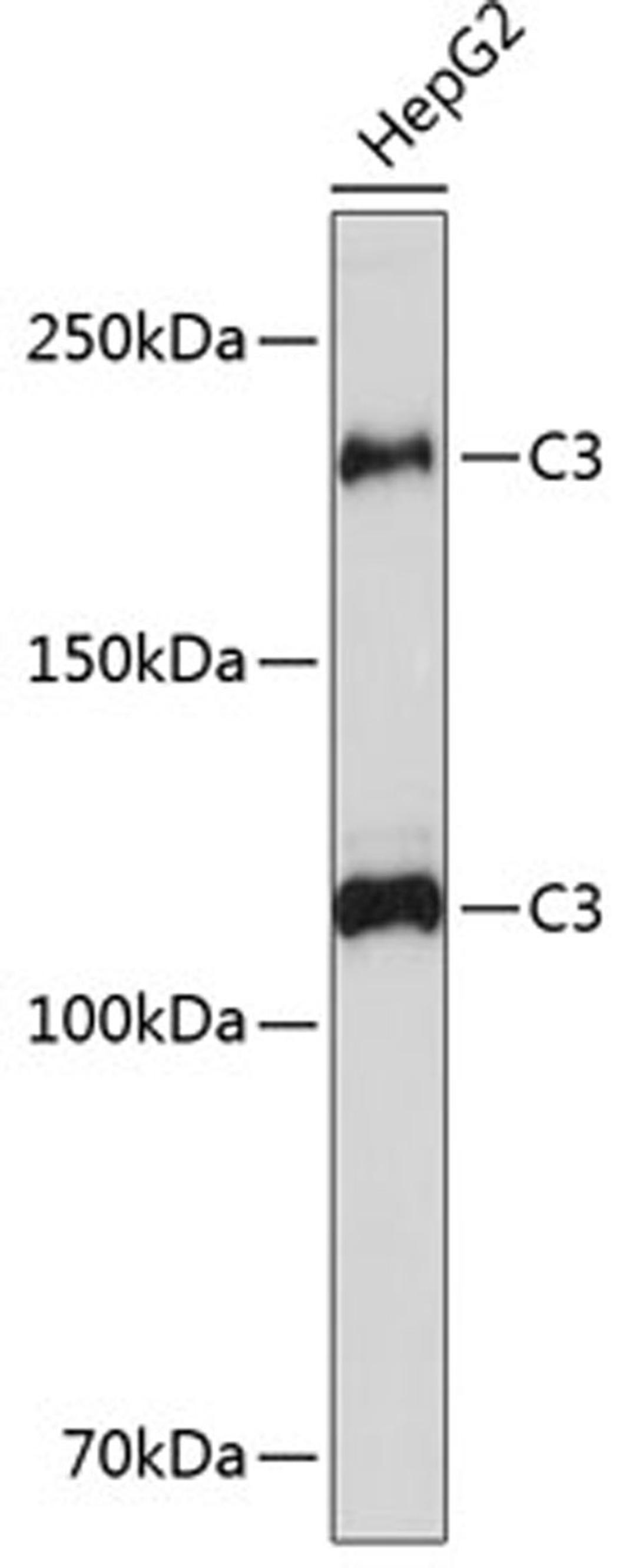 Western blot - C3 Rabbit mAb (A11196)