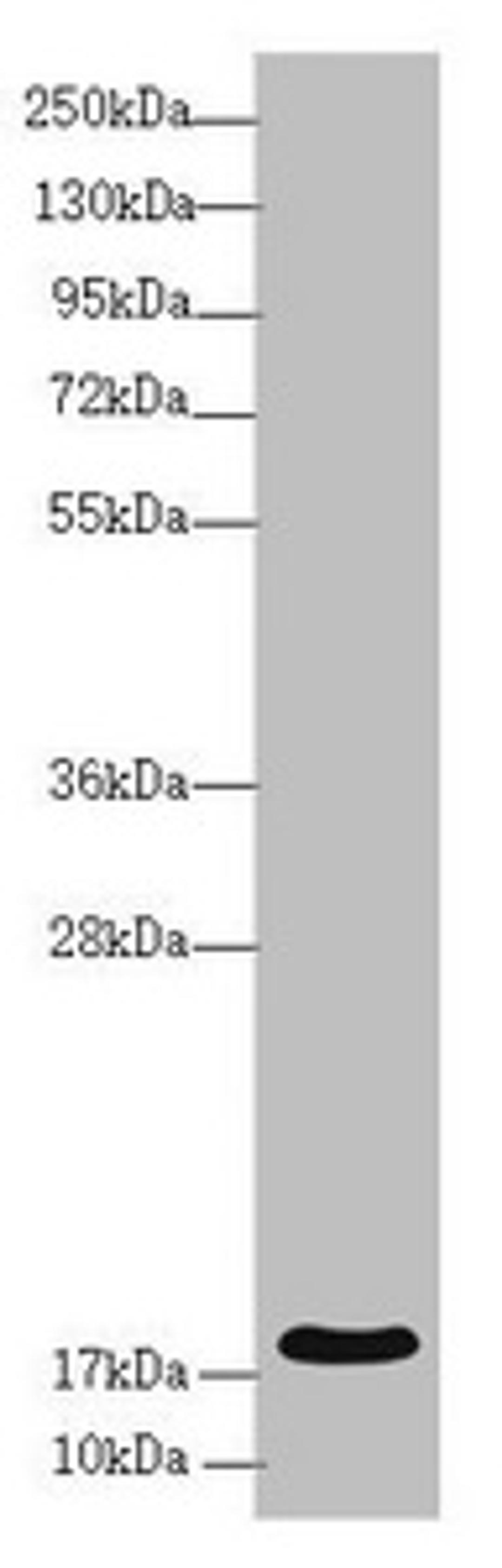 Western blot. All lanes: RNF5 antibody at 3.94 ug/ml + Mouse gonadal tissue. Secondary. Goat polyclonal to rabbit IgG at 1/10000 dilution. Predicted band size: 20 kDa. Observed band size: 20 kDa.