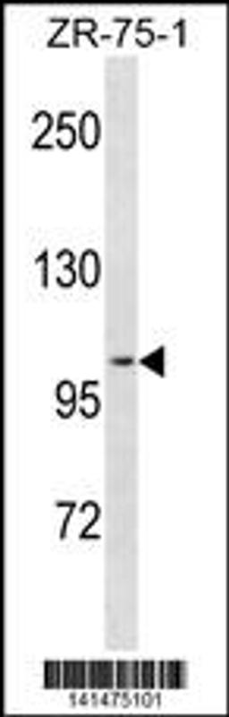 Western blot analysis in ZR-75-1 cell line lysates (35ug/lane).