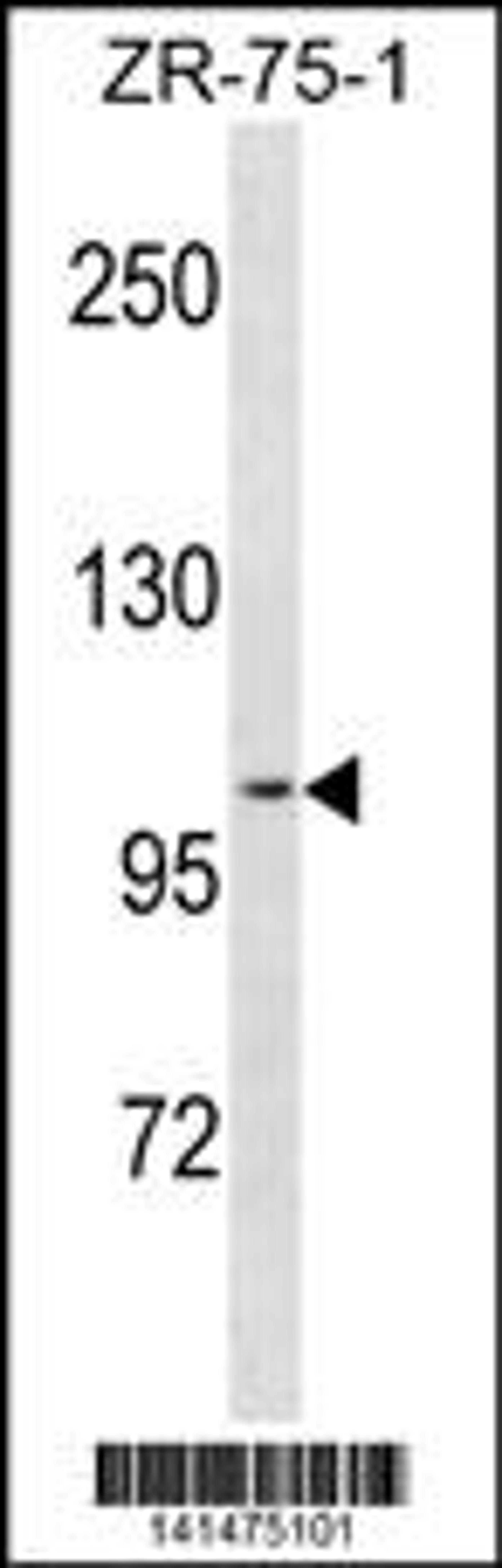 Western blot analysis in ZR-75-1 cell line lysates (35ug/lane).