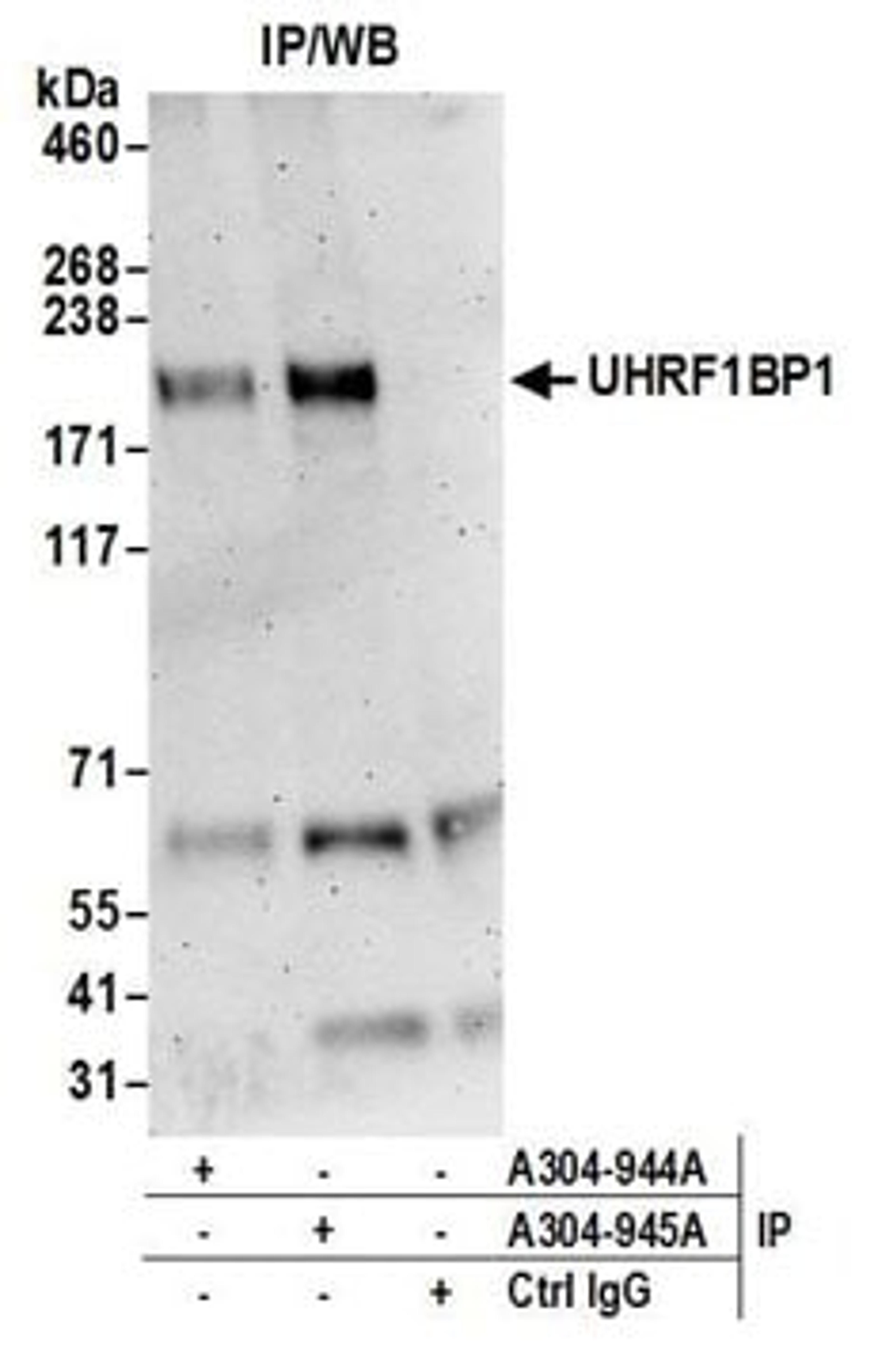 Detection of human UHRF1BP1 by western blot of immunoprecipitates.