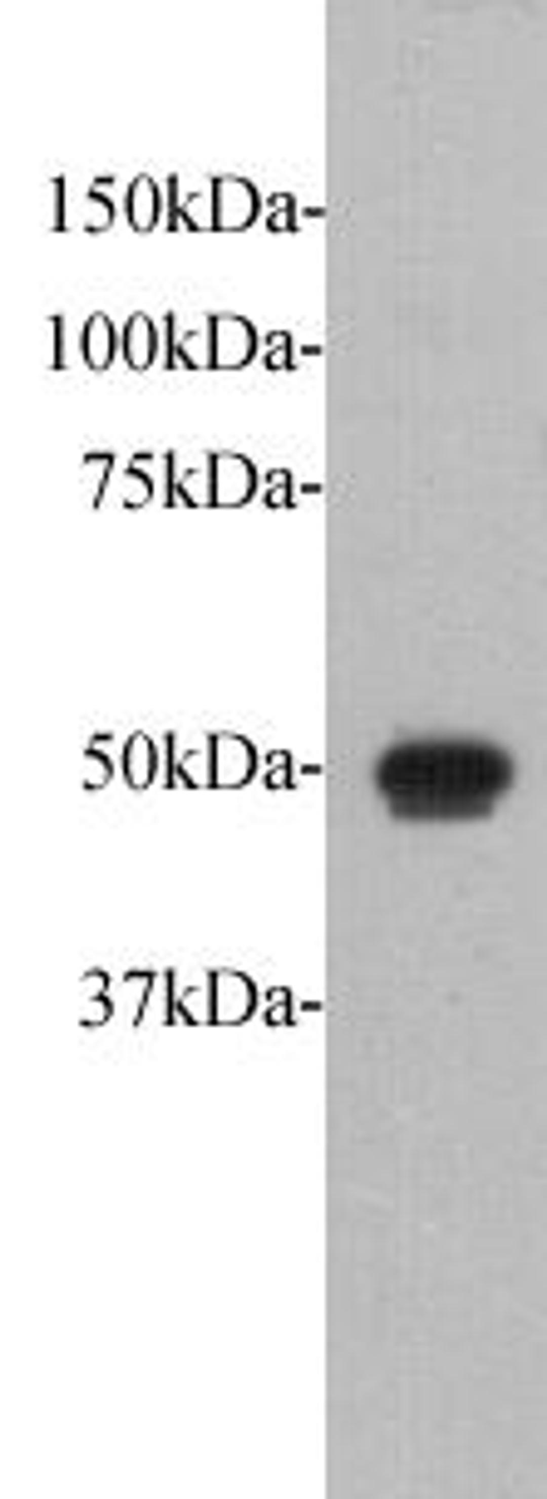 Western Blot analysis of Fat1 recombinant protein using Protocadherin Fat1 antibody