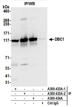 Detection of human DBC1 by western blot of immunoprecipitates.