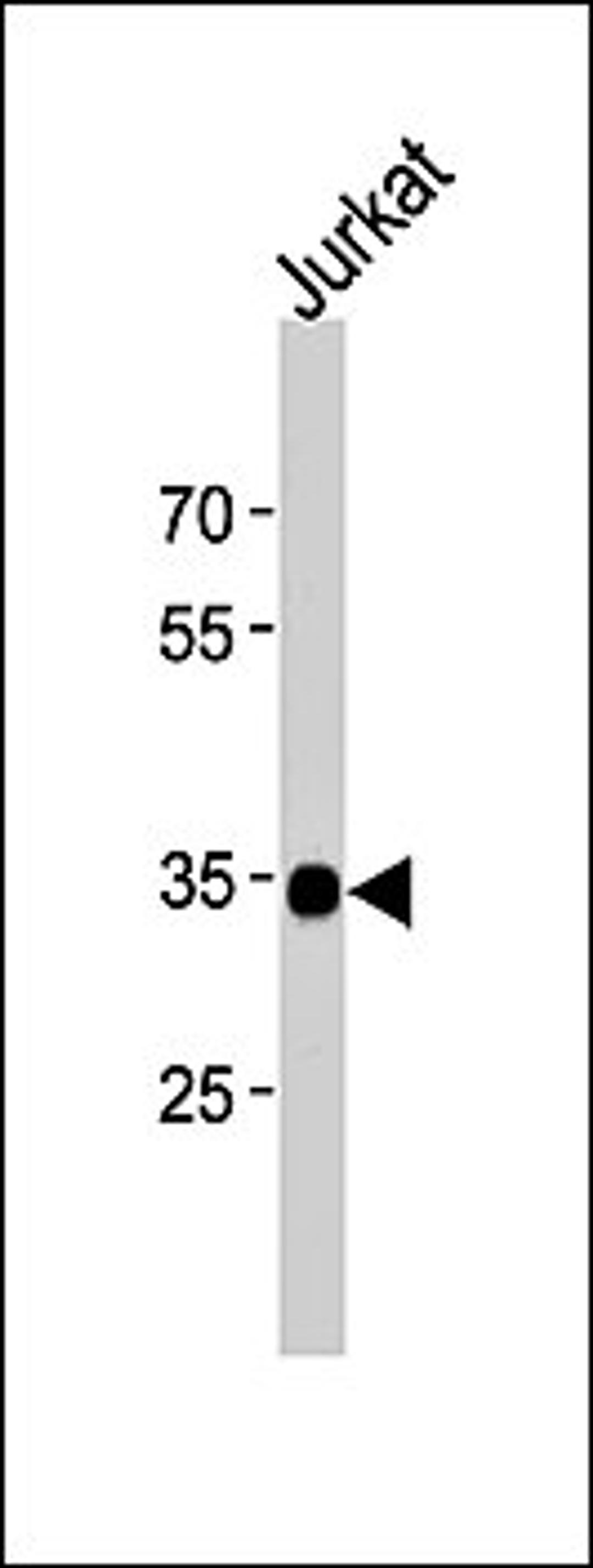 Western blot analysis of Jurkat cell line lysates (35ug/lane) using SOX18 (N-term) antibody