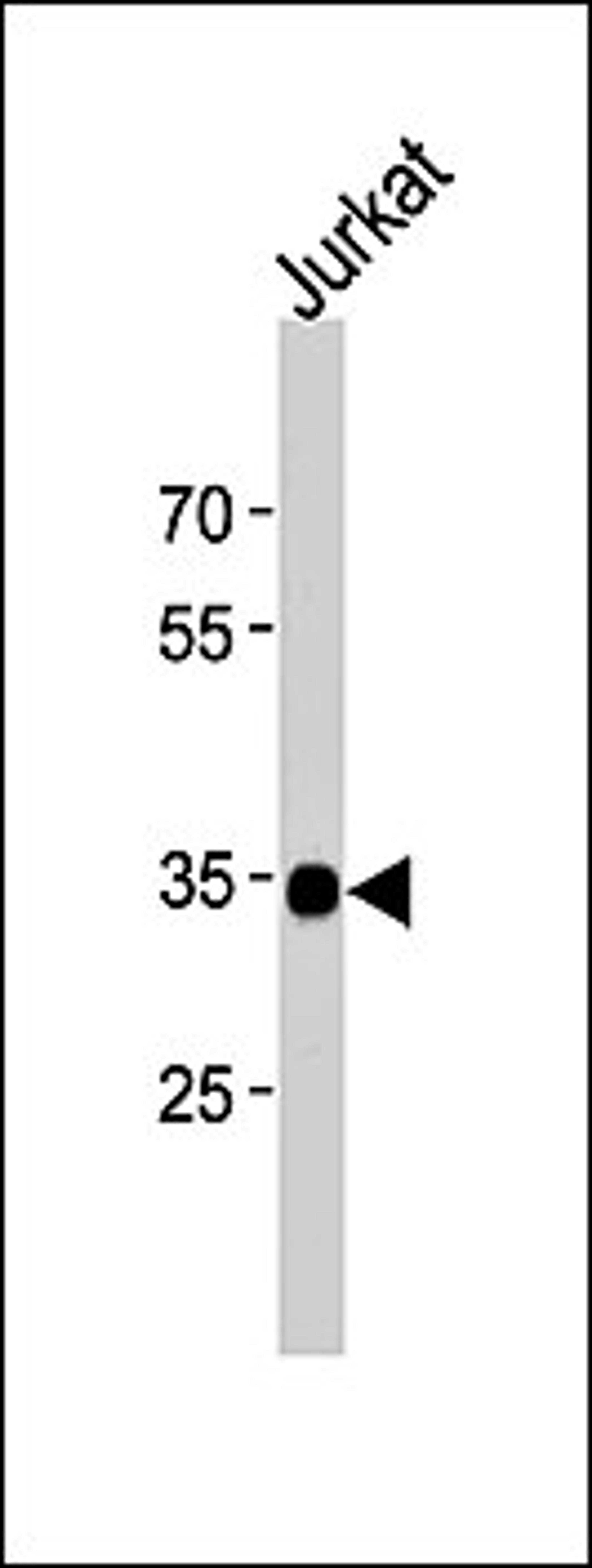 Western blot analysis of Jurkat cell line lysates (35ug/lane) using SOX18 (N-term) antibody