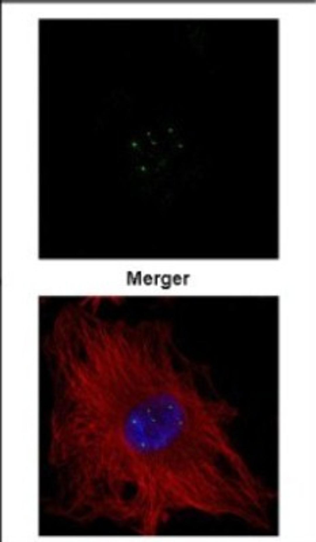 Immunocytochemistry/Immunofluorescence: Coilin Antibody [NBP2-15939] - Confocal immunofluorescence analysis of methanol-fixed HeLa, using Coilin antibody (Green) at 1:500 dilution. Alpha-tubulin filaments are labeled with Alpha-tubulin antibody (Red) at 1:500.