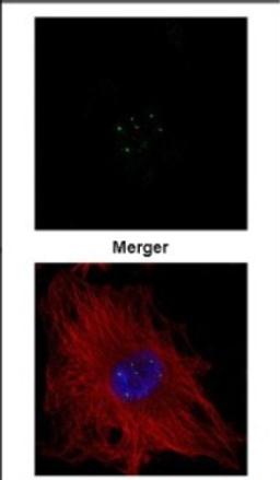 Immunocytochemistry/Immunofluorescence: Coilin Antibody [NBP2-15939] - Confocal immunofluorescence analysis of methanol-fixed HeLa, using Coilin antibody (Green) at 1:500 dilution. Alpha-tubulin filaments are labeled with Alpha-tubulin antibody (Red) at 1:500.