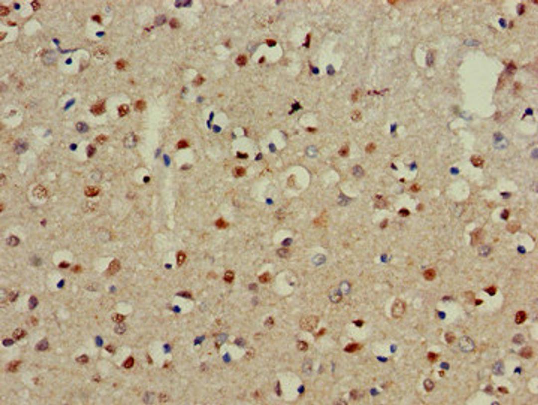 Immunohistochemistry of paraffin-embedded human brain tissue using CSB-PA004427LA01HU at dilution of 1:100