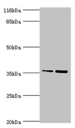 Western blot. All lanes: CFHR2 antibody at 2µg/ml. Lane 1: Hela whole cell lysate. Lane 2: 293T whole cell lysate. Secondary. Goat polyclonal to rabbit IgG at 1/10000 dilution. Predicted band size: 31, 28 kDa. Observed band size: 36 kDa