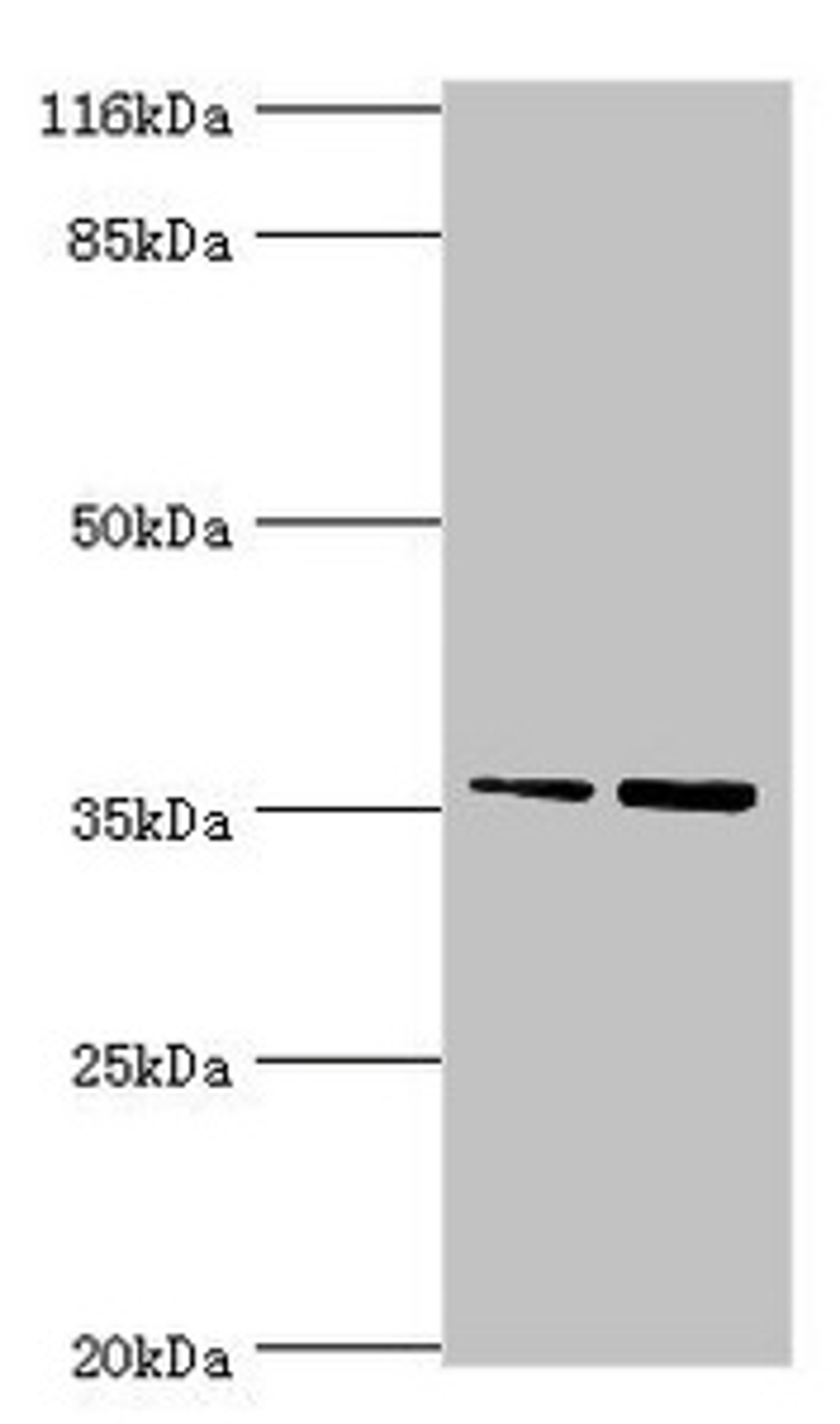 Western blot. All lanes: CFHR2 antibody at 2µg/ml. Lane 1: Hela whole cell lysate. Lane 2: 293T whole cell lysate. Secondary. Goat polyclonal to rabbit IgG at 1/10000 dilution. Predicted band size: 31, 28 kDa. Observed band size: 36 kDa