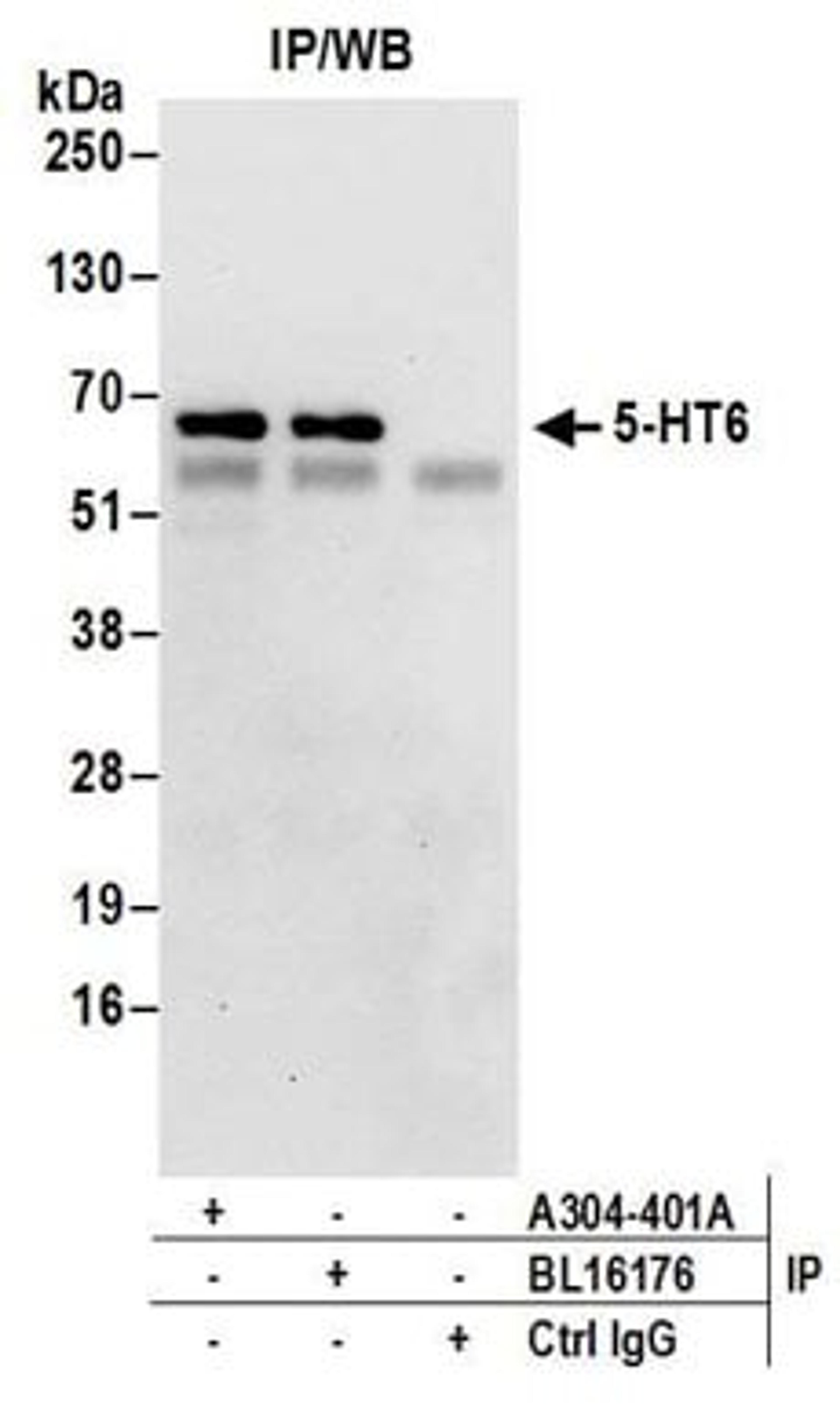 Detection of human 5-HT6 by western blot of immunoprecipitates.