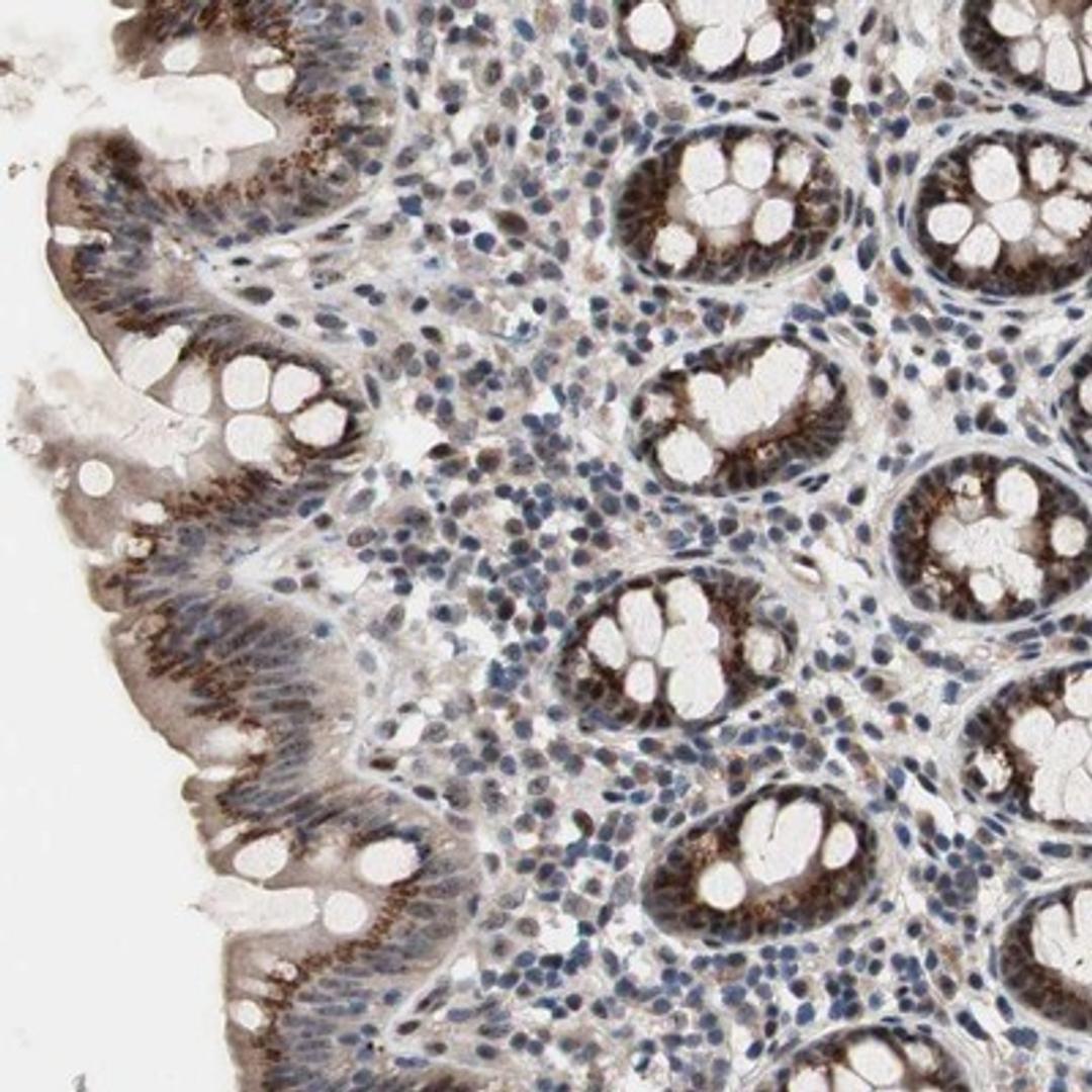 Immunohistochemistry-Paraffin: SOX7 Antibody [NBP1-86116] - Immunohistochemical staining of human colon shows moderate cytoplasmic and nuclear positivity in glandular cells.