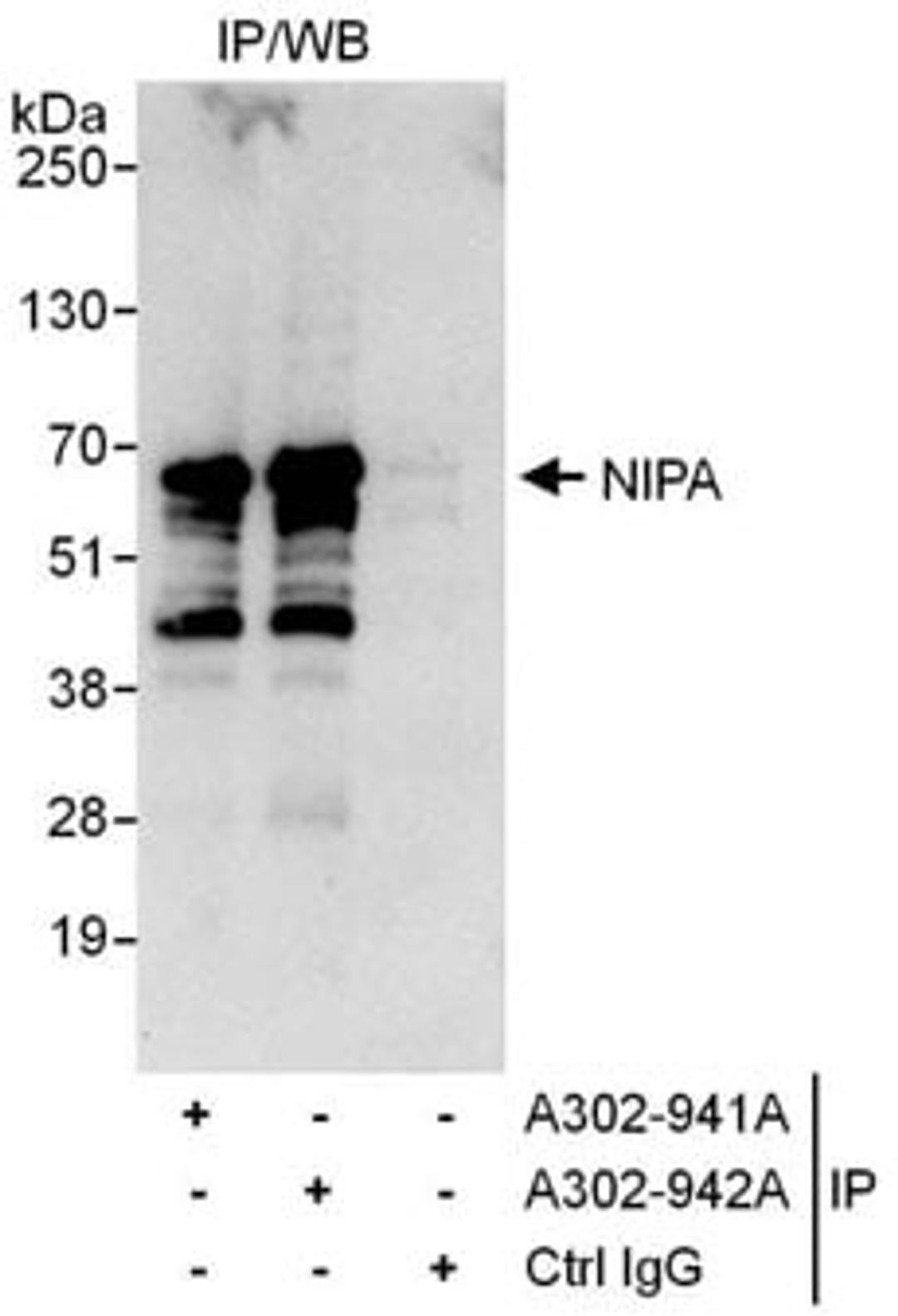 Detection of human NIPA by western blot of immunoprecipitates.