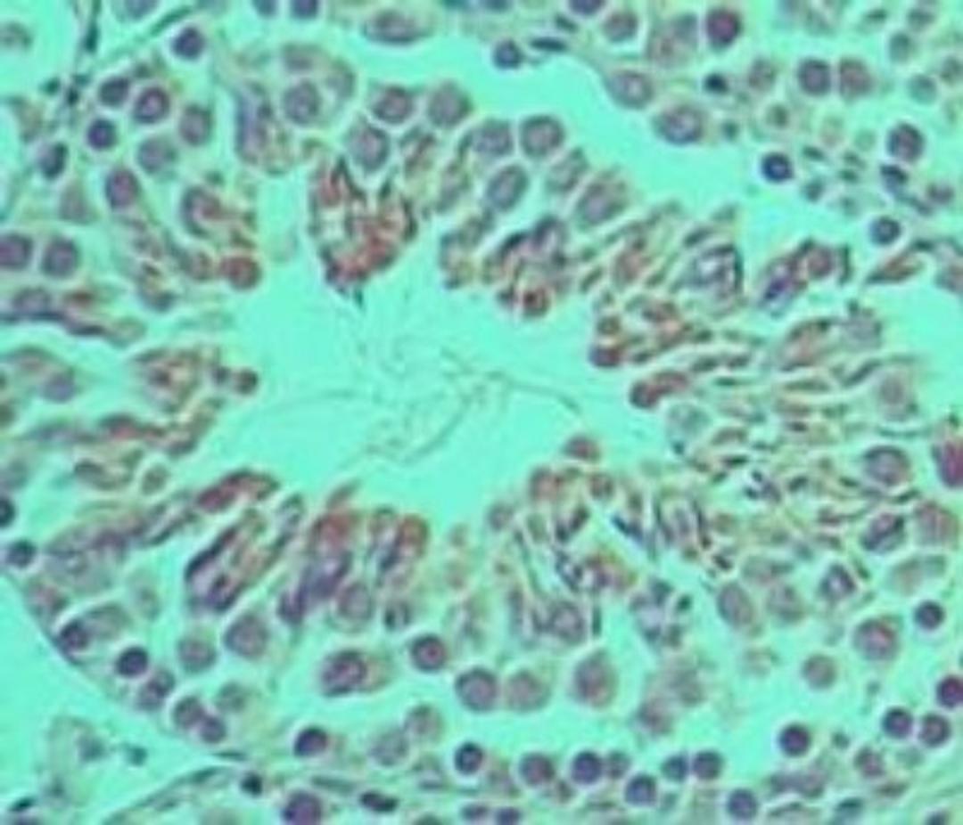 Immunohistochemistry-Paraffin: Ifi204 Antibody [NBP2-27153] - analysis of Ifi204 in formalin-fixed, paraffin-embedded mouse testis tissue using this antibody at 5 ug/ml.