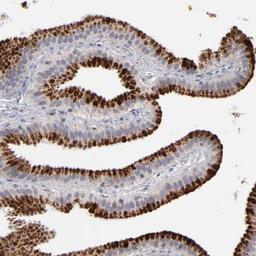 Immunohistochemistry-Paraffin: GPM6B Antibody [NBP1-81271] - Staining of human gall bladder shows strong cytoplasmic positivity in granular pattern in glandular cells.