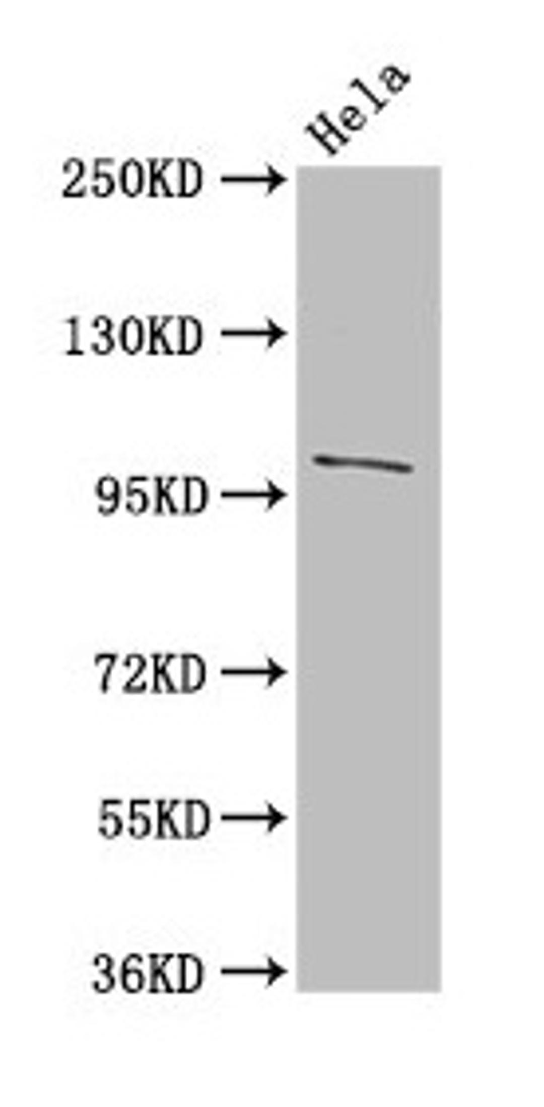 Western Blot. Positive WB detected in: Hela whole cell lysate. All lanes: NPC1 antibody at 3µg/ml. Secondary. Goat polyclonal to rabbit IgG at 1/50000 dilution. Predicted band size: 143, 108 kDa. Observed band size: 108 kDa