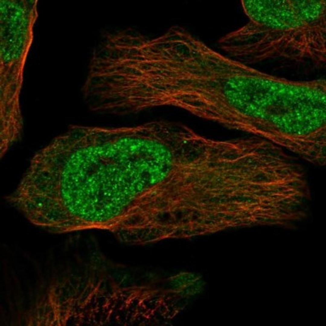 Immunocytochemistry/Immunofluorescence: SERTAD4 Antibody [NBP1-84217] - Staining of human cell line U-2 OS shows positivity in nucleus but not nucleoli & cytoplasm.