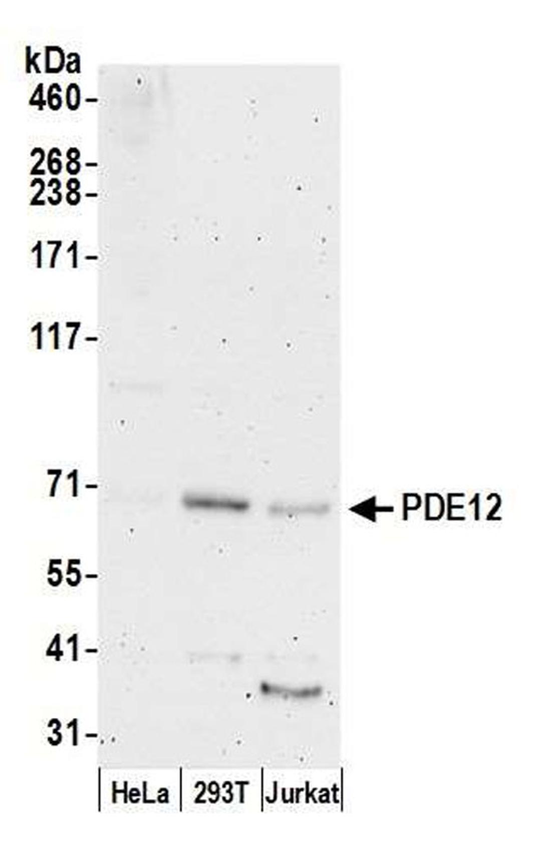 Detection of human PDE12 by WB.