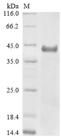 (Tris-Glycine gel) Discontinuous SDS-PAGE (reduced) with 5% enrichment gel and 15% separation gel.
