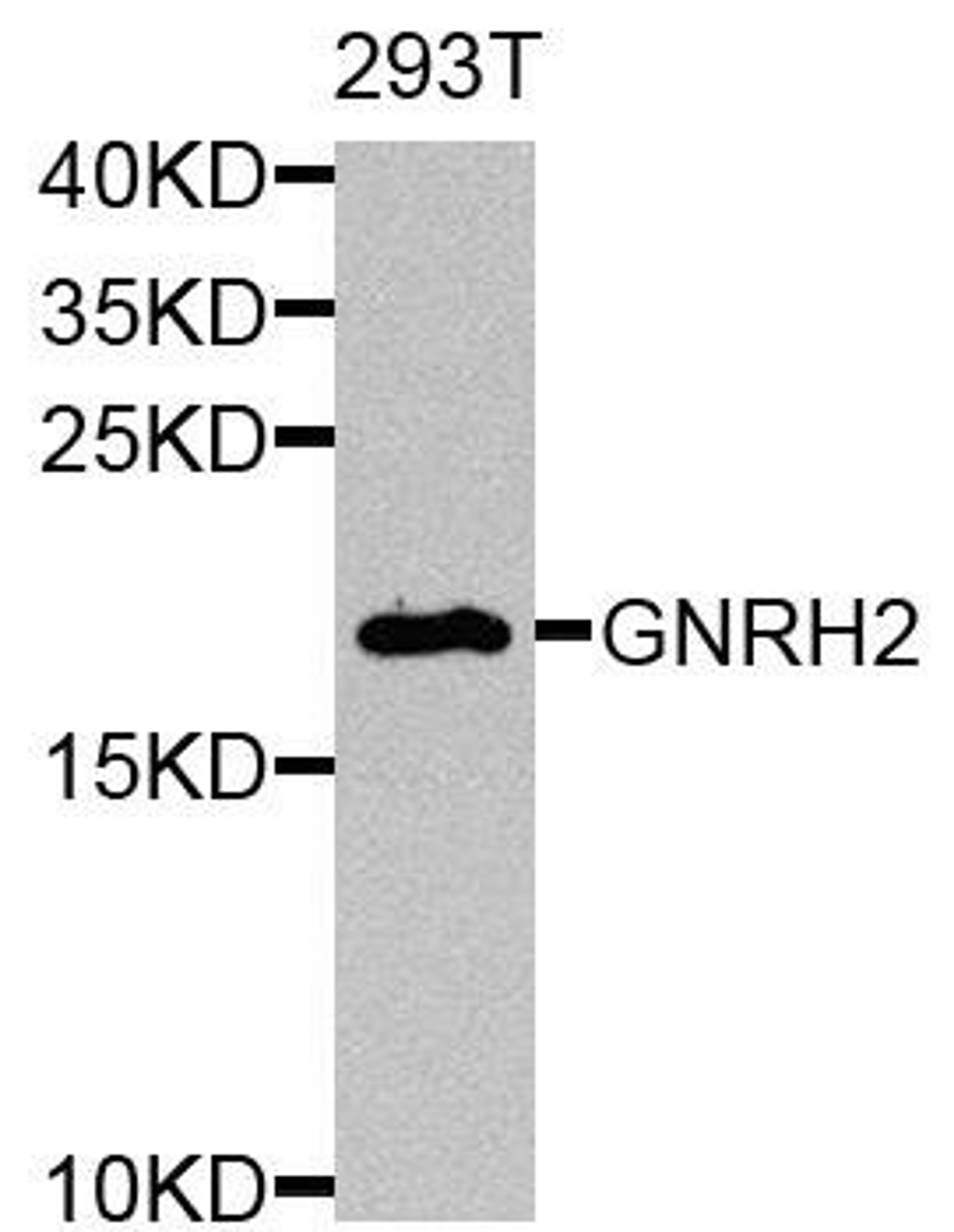 Western blot analysis of extracts of 293T cells using GNRH2 antibody