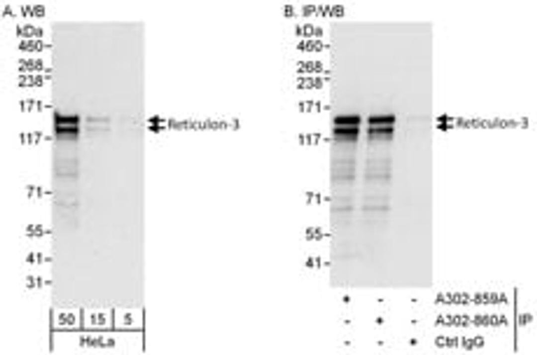 Detection of human Reticulon-3 by western blot and immunoprecipitation.