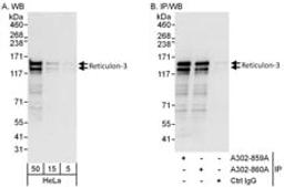 Detection of human Reticulon-3 by western blot and immunoprecipitation.