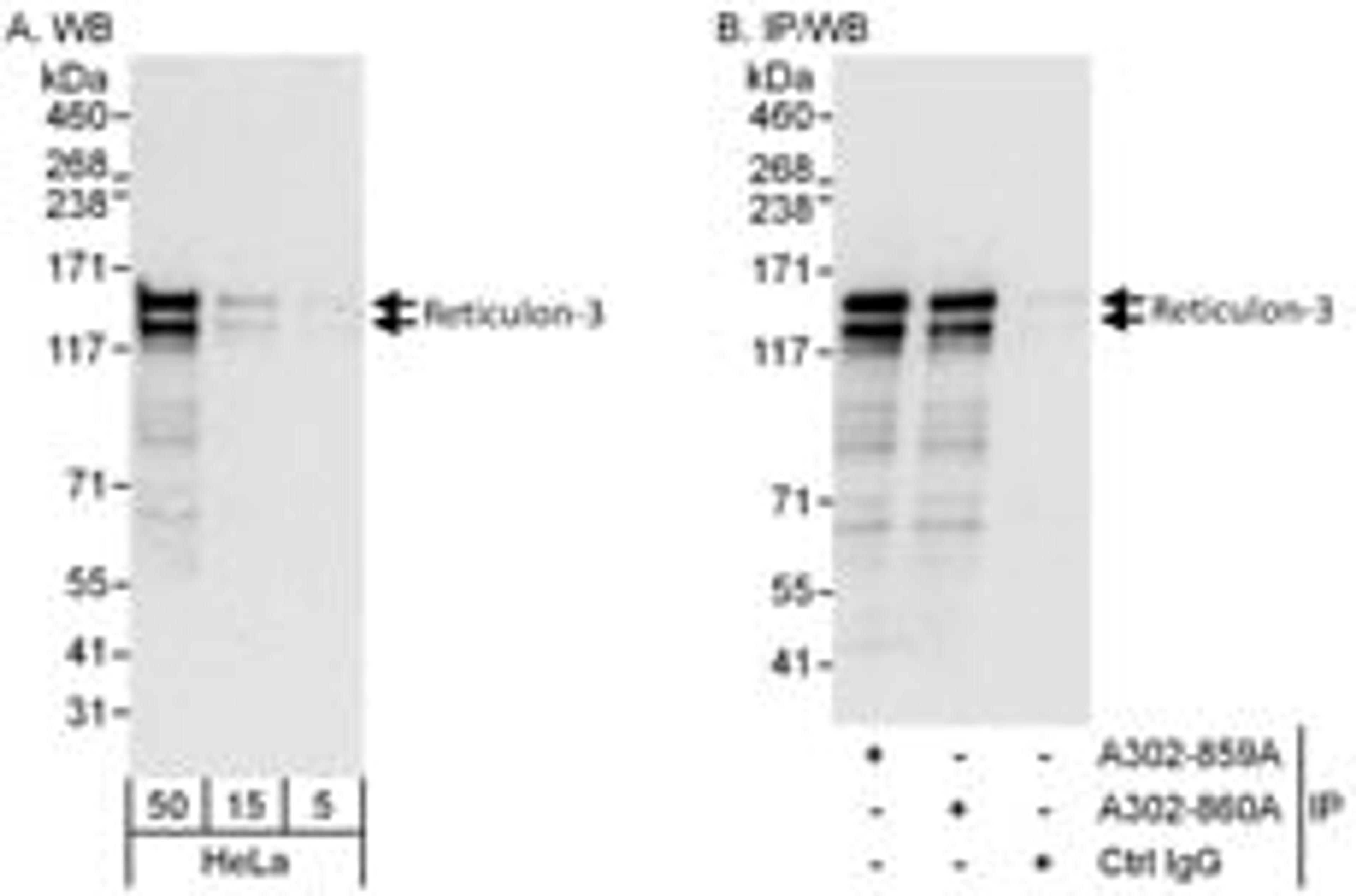 Detection of human Reticulon-3 by western blot and immunoprecipitation.