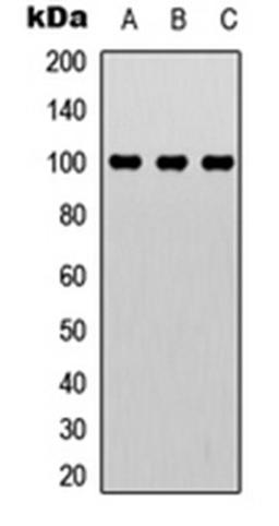 Western blot analysis of MCF7 (Lane 1), Jurkat (Lane 2), HeLa (Lane 3) whole cell lysates using CTIP antibody