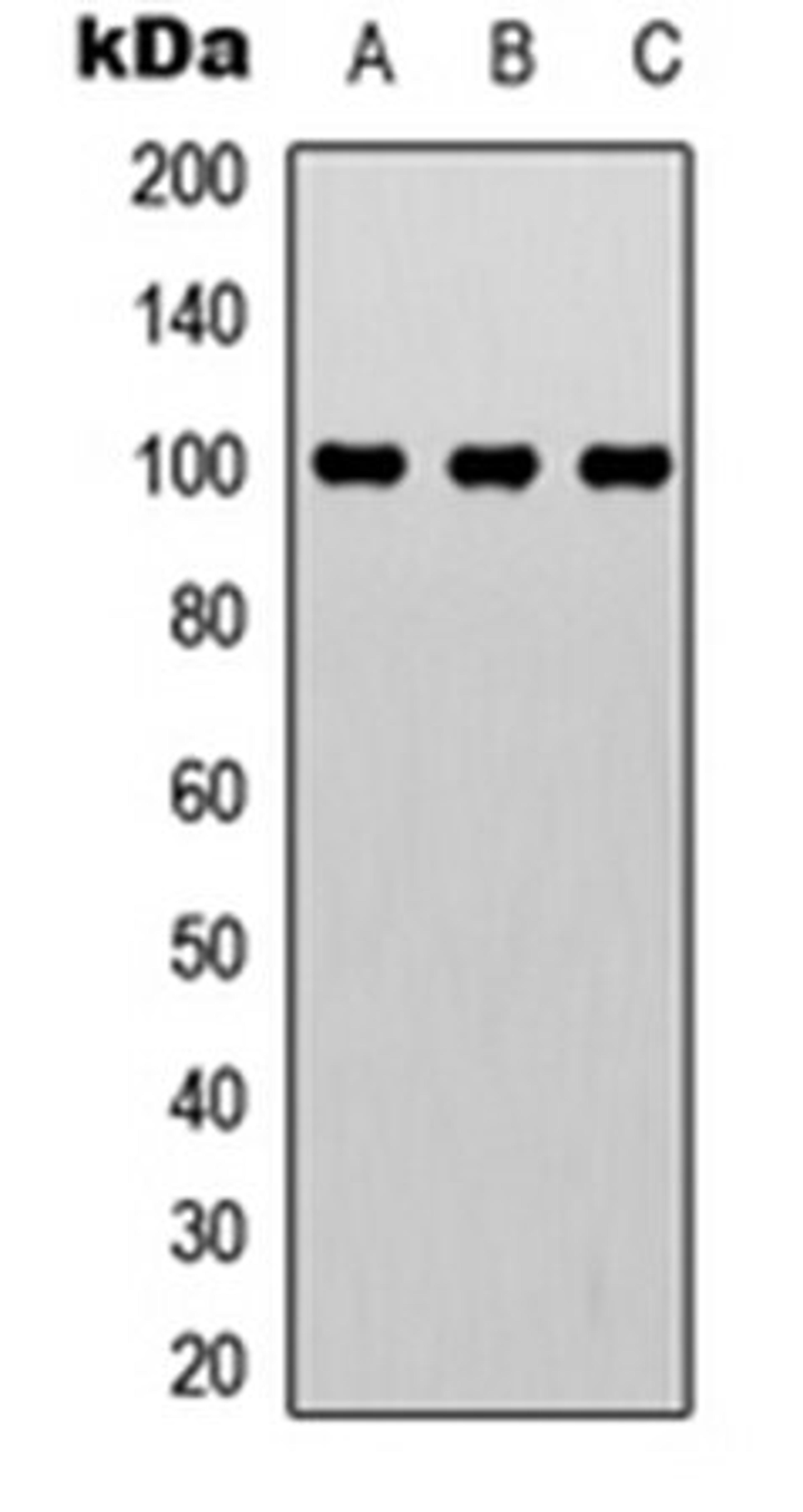 Western blot analysis of MCF7 (Lane 1), Jurkat (Lane 2), HeLa (Lane 3) whole cell lysates using CTIP antibody